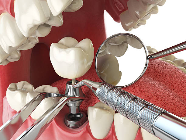 Best Emergency Root Canal Treatment in Trumann, AR